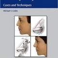دانلود کتاب جراحی زیبایی بینی: موارد و تکنیک ها<br>Rhinoplasty: Cases and Techniques, 1ed