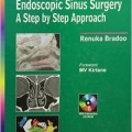 دانلود کتاب اصول تشریحی جراحی آندوسکوپی سینوس<br>Anatomical Principles of Endoscopic Sinus Surgery: A Step by Step Approach