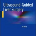 دانلود کتاب اطلس جراحی کبد هدایت اولتراسوند<br>Ultrasound-Guided Liver Surgery: An Atlas