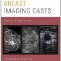 دانلود کتاب موارد تصویربرداری پستان<br>Breast Imaging Cases