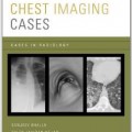دانلود کتاب موارد تصویربرداری قفسه سینه<br>Chest Imaging Cases