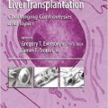 دانلود کتاب پیوند کبد: به چالش کشیدن مباحث<br>Liver Transplantation: Challenging Controversies and Topics