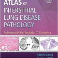 دانلود کتاب اطلس آسیب شناسی بیماری ریه بینابینی: پاتولوژی همراه با CT رزولوشن بالا<br>Atlas of Interstitial Lung Disease Pathology: Pathology with High Resolution CT Correlations, 1ed