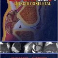 دانلود کتاب EXPERTddx: رادیولوژی اسکلتی - عضلانی <br>EXPERTddx: Musculoskeletal: Published by Amirsys