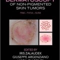 دانلود کتاب درماتوسکوپی تومورهای پوست غیر رنگی<br>Dermatoscopy of Non-Pigmented Skin Tumors: Pink - Think - Blink