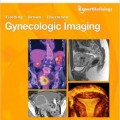 دانلود کتاب تصویربرداری زنان و زایمان (سری کارشناس رادیولوژی)<br>Gynecologic Imaging (Expert Radiology Series), 1ed