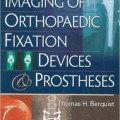 دانلود کتاب تصویربرداری ارتوپدی تثبیت ابزار و پروتزها<br>Imaging of Orthopaedic Fixation Devices and Prostheses, 1ed