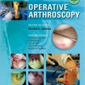دانلود کتاب آرتروسکوپی عملی جانسون<br>Operative Arthroscopy, 4ed