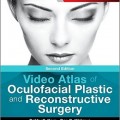 دانلود کتاب اطلس جراحی پلاستیک و ترمیمی چشم (ویرایش 2017)<br>Video Atlas of Oculofacial Plastic and Reconstructive Surgery, 2ed