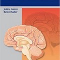 دانلود کتاب همراه ضروری جراحی مغز و اعصاب <br>The Essential Neurosurgery Companion, 1ed