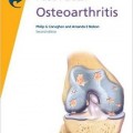 دانلود کتاب حقایق سریع: آرتروز <br>Fast Facts: Osteoarthritis, 2ed
