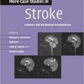 دانلود کتاب مطالعات موردی بیشتر در سکته: معرفی موارد معمول و غیر معمول<br>More Case Studies in Stroke: Common and Uncommon Presentations, 1ed
