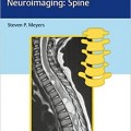 دانلود کتاب تشخیص افتراقی در تصویربرداری عصبی: ستون فقرات<br>Differential Diagnosis in Neuroimaging: Spine, 1ed