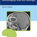 دانلود کتاب تشخیص افتراقی در تصویربرداری عصبی: مغز و مننژ<br>Differential Diagnosis in Neuroimaging: Brain and Meninges, 1ed