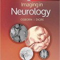 دانلود کتاب تصویربرداری در مغز و اعصاب آزبورن<br>Imaging in Neurology, 1ed