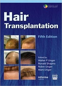دانلود کتاب کاشت مو Hair Transplantation, 5ed
