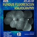 دانلود کتاب آنژیوگرافی فلورسین عمقی سانکارا<br>The Sankara Nethralaya Atlas of Fundus Fluorescein Angiography, 2ed