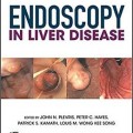 دانلود کتاب آندوسکوپی در بیماری کبد<br>Endoscopy in Liver Disease, 1ed