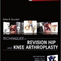 دانلود کتاب تکنیک هایی در آرتروپلاستی اصلاحی مفصل ران و زانو + ویدئو<br>Techniques in Revision Hip and Knee Arthroplasty, 1ed + Video