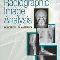دانلود کتاب آنالیز تصویر رادیوگرافی <br>Radiographic Image Analysis, 4ed
