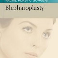 دانلود کتاب بلفاروپلاستی (روشهای جراحی پلاستیک صورت توماس)<br>Blepharoplasty (Thomas Procedures in Facial Plastic Surgery), 1ed