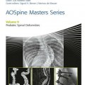 دانلود کتاب سری کارشناسی ستون فقرات AO: ناهنجاری های ستون فقرات کودکان (جلد 9)<br>AOSpine Masters Series, Volume 9: Pediatric Spinal Deformities, 1ed