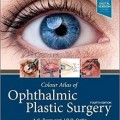 دانلود کتاب اطلس رنگی جراحی پلاستیک چشم<br>Colour Atlas of Ophthalmic Plastic Surgery, 4ed