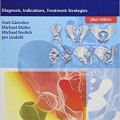 دانلود کتاب شکستگی های حفره حقه‌ ای: تشخیص، علائم، استراتژی های درمان + ویدئو<br>Acetabular Fractures: Diagnosis, Indications, Treatment Strategies, 1ed + Video