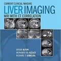 دانلود کتاب تصویر برداری کبدی: MRI با همبستگی CT<br>Liver Imaging: MRI with CT Correlation, 1ed