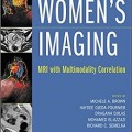 دانلود کتاب تصویربرداری زنان: MRI با همبستگی چند وجهی<br>Women's Imaging: MRI with Multimodality Correlation, 1ed