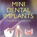 دانلود کتاب ایمپلنت دندانی کوچک: اصول و تمرین<br>Mini Dental Implants: Principles and Practice, 1ed