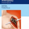 دانلود کتاب آرتروپلاستی شانه معکوس: رویکرد عملی + ویدئو<br>Reverse Shoulder Arthroplasty: A Practical Approach, 1ed + Video