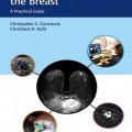 دانلود کتاب راهنمای عملی MRI مختصر از پستان<br>Abbreviated MRI of the Breast: A Practical Guide, 1ed