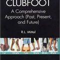 دانلود کتاب پاچنبری: یک رویکرد جامع<br>Clubfoot: A Comprehensive Approach, 1ed