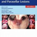دانلود کتاب اطلس ضایعات سلار، سوپراسلار و پاراسلار + ویدئو<br>Atlas of Sellar, Suprasellar, and Parasellar Lesions, 1ed + Video