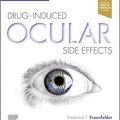 دانلود کتاب عوارض چشمی ناشی از دارو: سم شناسی بالینی چشم<br>Drug-Induced Ocular Side Effects: Clinical Ocular Toxicology, 8ed