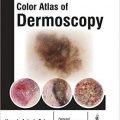 دانلود کتاب اطلس رنگی درموسکوپی <br>Colour Atlas of Dermoscopy, 1ed