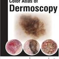 دانلود کتاب اطلس رنگی درموسکوپی <br>Color Atlas of Dermoscopy, 1ed