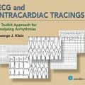دانلود کتاب نوار قلب و ردیابی داخل قلب<br>ECG and Intracardiac Tracings, 1ed