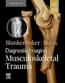 دانلود کتاب Diagnostic Imaging: Musculoskeletal Trauma, 3ed