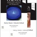 دانلود کتاب قرنیه (2 جلدی) + ویدئو<br>Cornea, 2-Volume Set, 5ed + Video