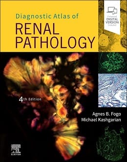 دانلود کتاب Diagnostic Atlas of Renal Pathology, 4ed