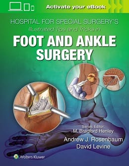 دانلود کتاب Illustrated Tips and Tricks in Foot and Ankle Surgery, 1ed