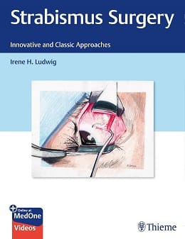 دانلود کتاب Strabismus Surgery: Innovative and Classic Approaches, 1ed