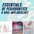 دانلود کتاب ملزومات پریودونتیک و ایمپلنتولوژی دهان<br>Essentials of Periodontics and Oral Implantology, 1ed