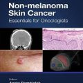 دانلود کتاب سرطان پوست غیر ملانوما: موارد ضروری برای انکولوژیست ها<br>Non-melanoma Skin Cancer: Essentials for Oncologists, 1ed
