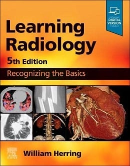 دانلود کتاب Learning Radiology: Recognizing the Basics, 5ed + Video