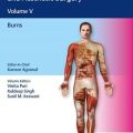 دانلود کتاب جراحی پلاستیک، ترمیمی و زیبایی: سوختگی ها (جلد 5)<br>Textbook of Plastic, Reconstructive and Aesthetic Surgery: Burns, 1ed