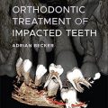 دانلود کتاب درمان ارتودنسی دندان های نهفته<br>Orthodontic Treatment of Impacted Teeth, 4ed