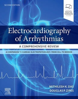 دانلود کتاب Electrocardiography of Arrhythmias: A Comprehensive Review, 2ed